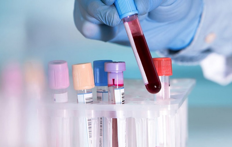 Xét nghiệm máu giúp phát hiện các bệnh lý về máu