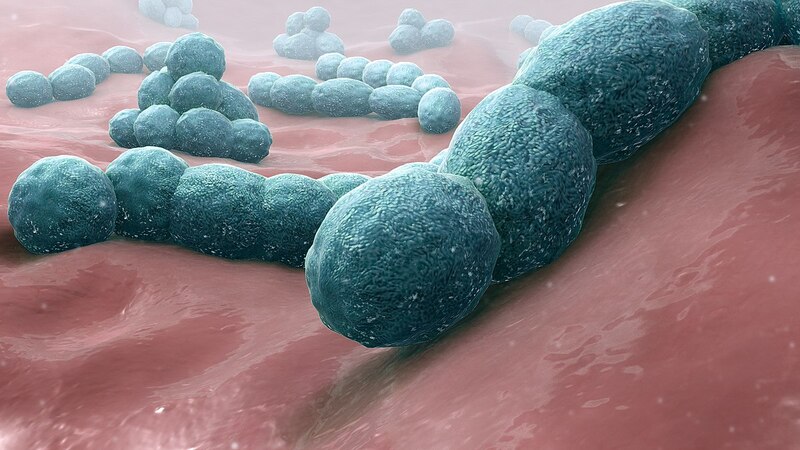 Phế cầu khuẩn có thể gây viêm tai giữa nghiêm trọng