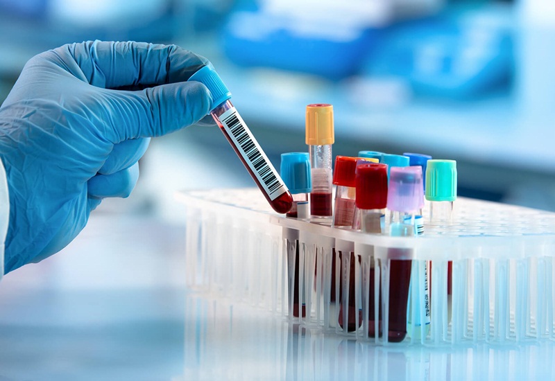 Lấy mẫu xét nghiệm máu tại nhà vẫn đảm bảo kết quả chính xác