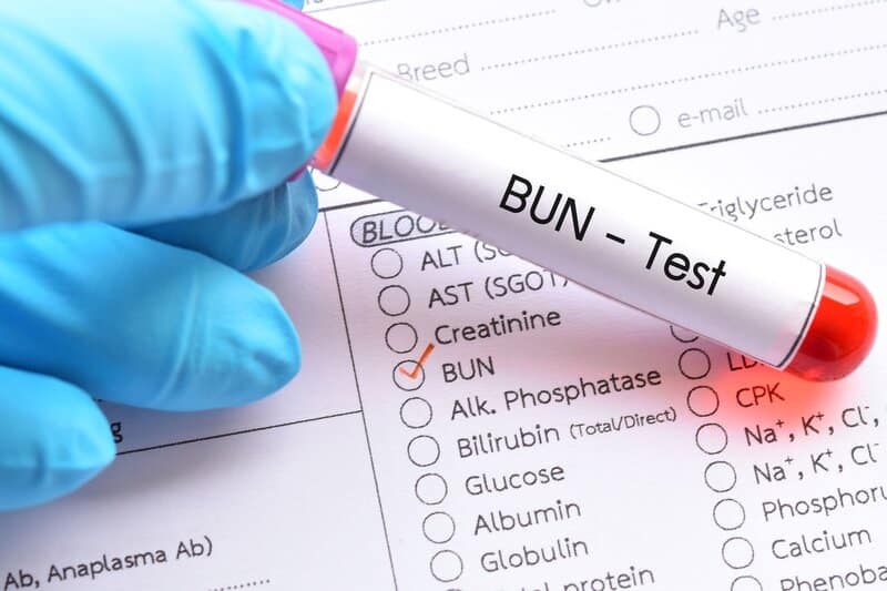 Kết quả xét nghiệm BUN giúp bác sĩ có cơ sở để đánh giá chức năng gan, thận