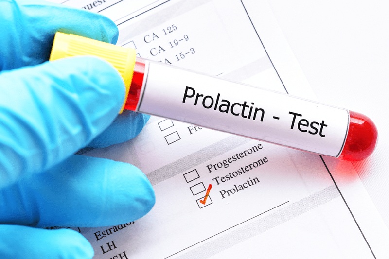 Xét nghiệm Prolactin nhằm đánh giá những bất thường trong buồng trứng