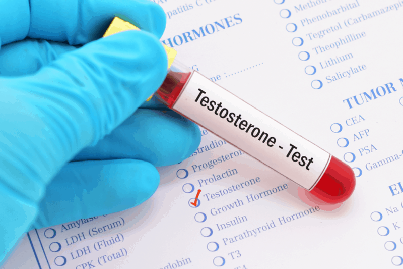 Xét nghiệm Testosterone nhằm phát hiện buồng trứng đa nang hoặc các dạng u hiếm gặp ở nữ giới