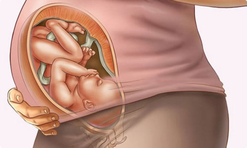 Dấu hiệu bụng tụt xuống dưới phổ biến với thai phụ