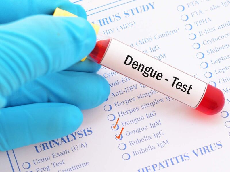 Xét nghiệm sốt xuất huyết kháng nguyên Dengue NS1