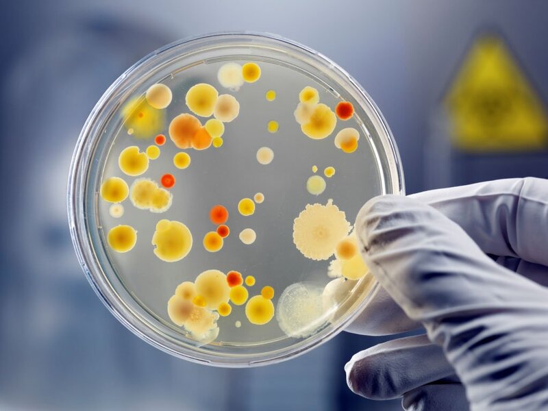 Xét nghiệm nuôi cấy vi khuẩn giúp chẩn đoán bệnh chính xác