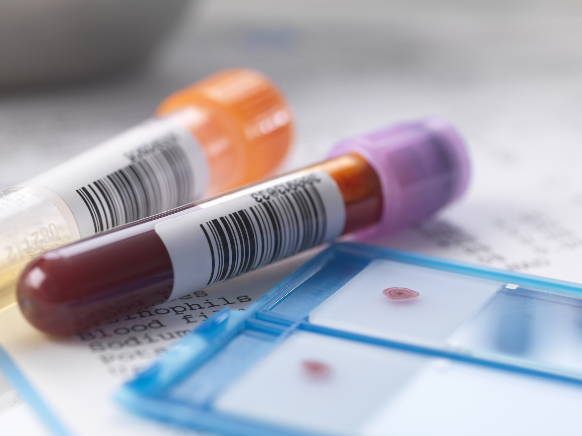Có nhiều loại xét nghiệm viêm gan B