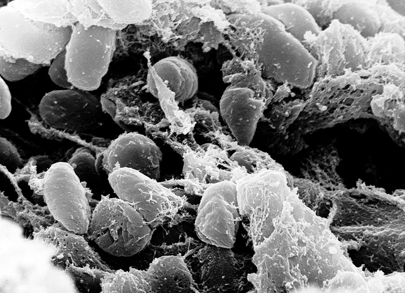 Mô phỏng vi khuẩn gây bệnh qua lớp kính hiển vi