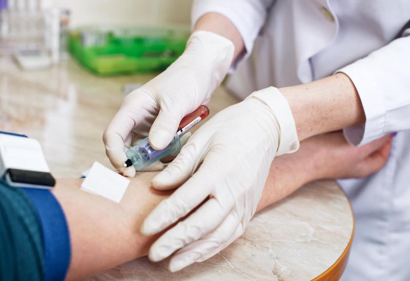 Cần biết chính xác sốt mấy ngày thì xét nghiệm sốt xuất huyết để nhanh chóng kiểm tra tình trạng bệnh