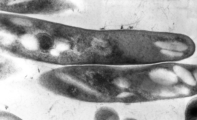Vi khuẩn Mycobacterium leprae - tác nhân gây ra bệnh phong