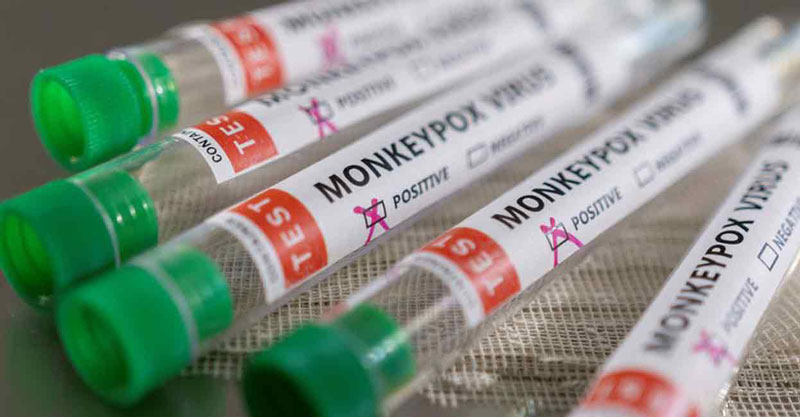 Người nghi nhiễm đậu mùa khỉ nên chủ động đi xét nghiệm PCR