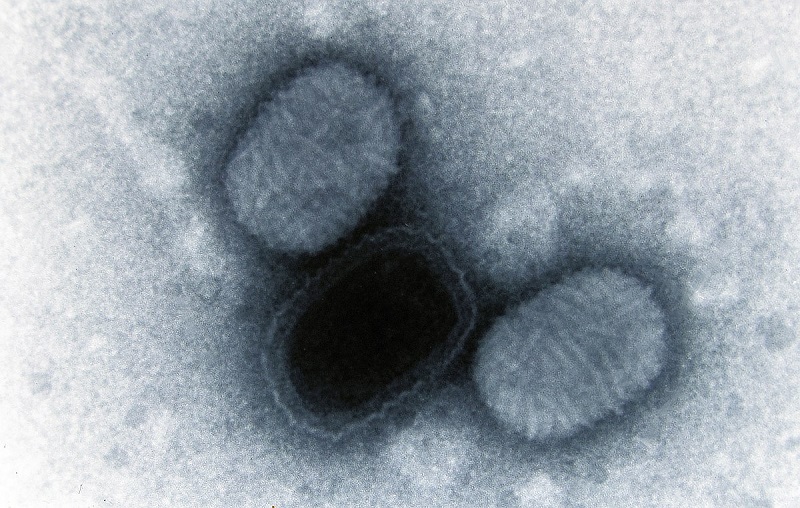 Virus Molluscum contagiosum gây ra bệnh u mềm lây
