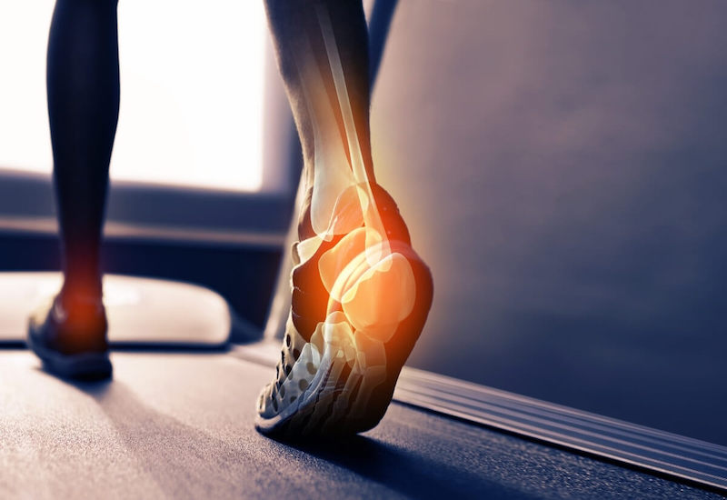 Dựa trên tình trạng đứt gân gót chân mà sẽ áp dụng phương pháp điều trị phù hợp