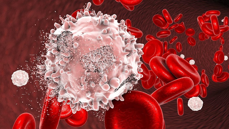 Ung thư máu là căn bệnh ác tính do sự tăng sinh đột biến của các tế bào bạch cầu