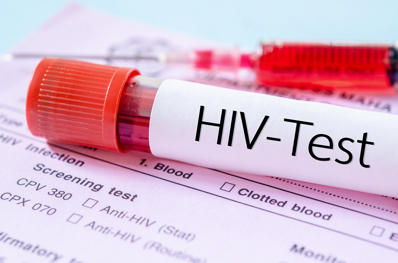 Dịch vụ xét nghiệm HIV tại nhà ở Bình Dương đem đến giải pháp về tâm lý cho người bệnh