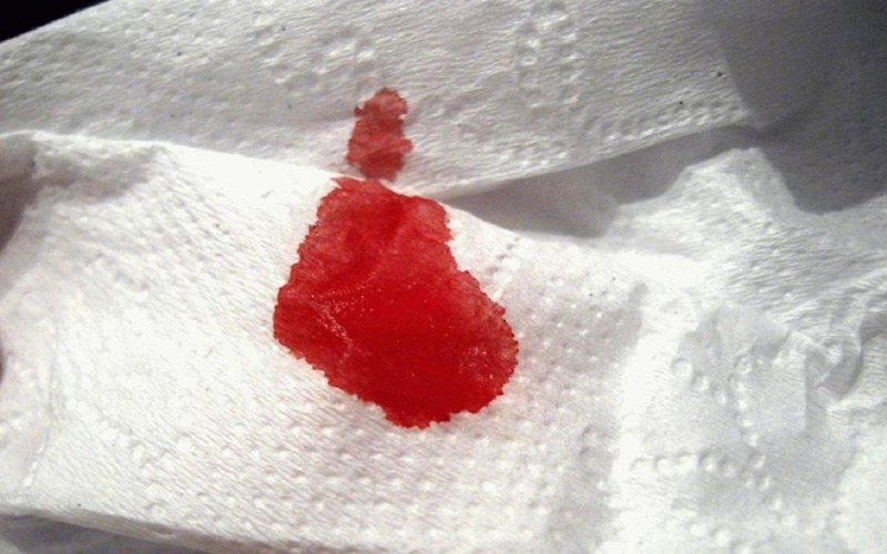  Mọi tình huống chảy máu bất thường đều không được xem nhẹ, nhất là khi nôn ra máu, ho ra máu,… 