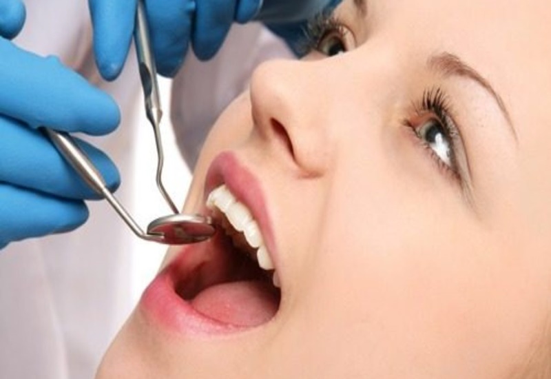 Khám răng là một bước không thể thiếu trong quy trình lấy cao răng