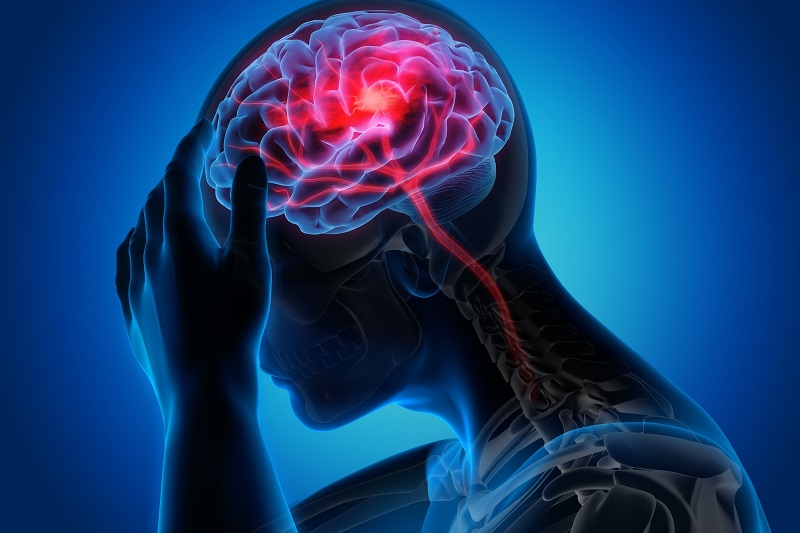 Người thường xuyên bị đau nửa đầu nên khám Nội thần kinh để được chẩn đoán đúng bệnh