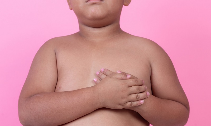 Trẻ béo phì có nguy cơ mắc nhiều loại bệnh nguy hiểm