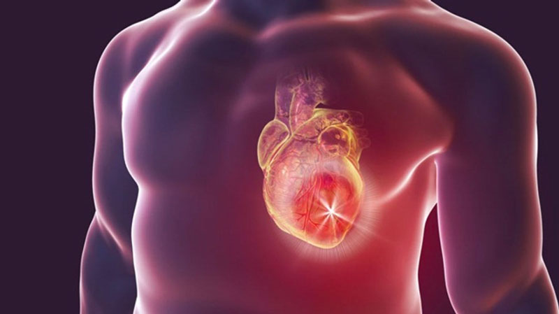 Suy tim là nguyên nhân nghiêm trọng khiến người bệnh bị khó thở khi đêm về