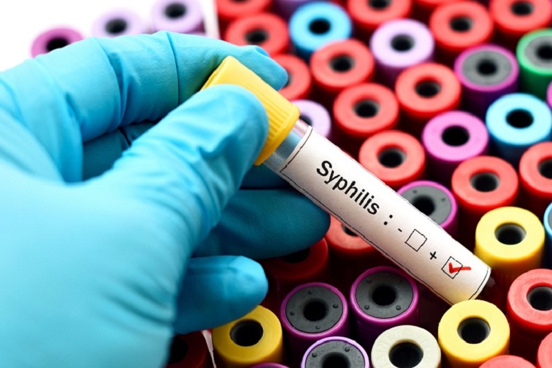 Test Syphilis giúp chẩn đoán bệnh giang mai