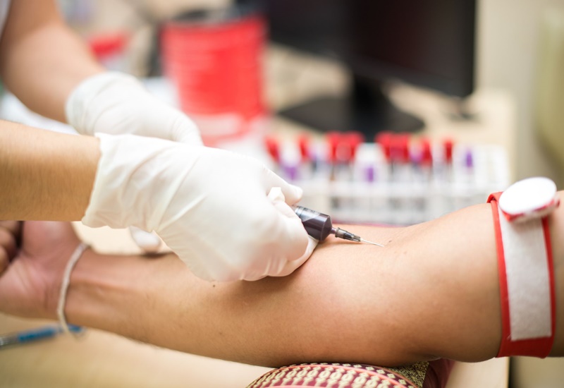 Lấy mẫu máu để phục vụ xét nghiệm vi sinh