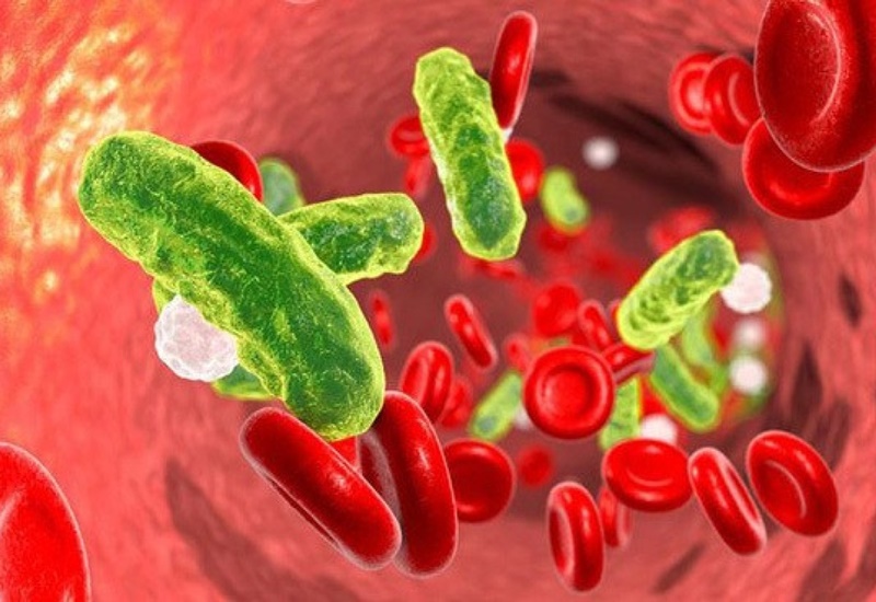 Xét nghiệm vi sinh có thể phát hiện bệnh nhiễm trùng máu