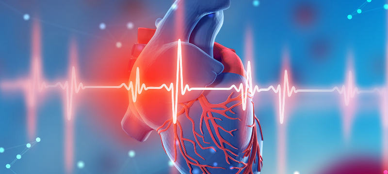 Thiếu máu cục bộ có thể dẫn đến tình trạng nhồi máu cơ tim