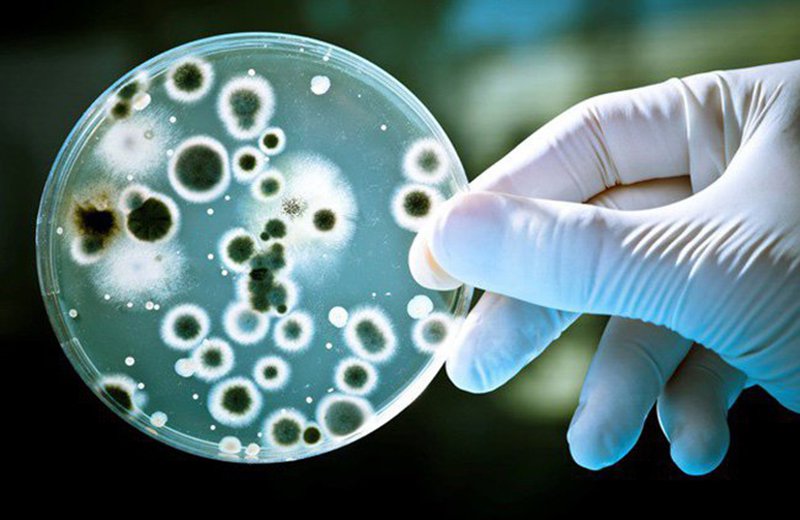 Xét nghiệm cấy da giúp tìm ra sự tồn tại hoặc vi khuẩn hoặc vi nấm gây viêm da quanh miệng