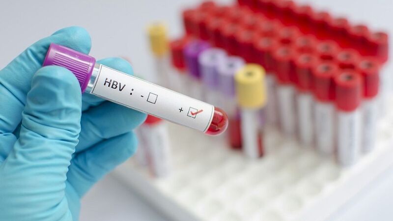 Xét nghiệm HBsAg để kiểm tra bạn có nhiễm virus viêm gan B hay không