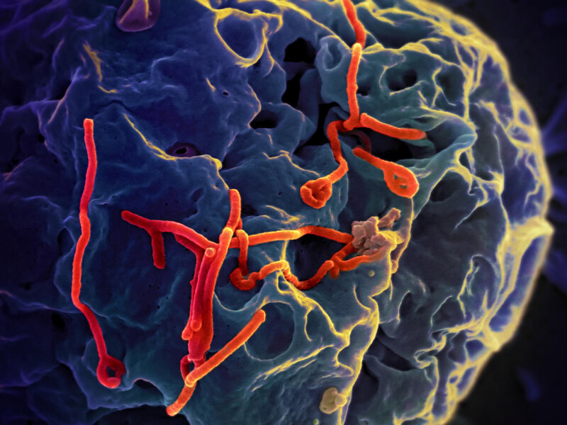Virus Ebola có thể tấn công vào nhiều cơ quan nội tạng