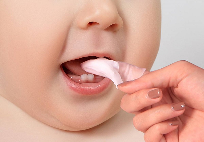 Điều trị nấm miệng ở trẻ chủ yếu bằng thuốc