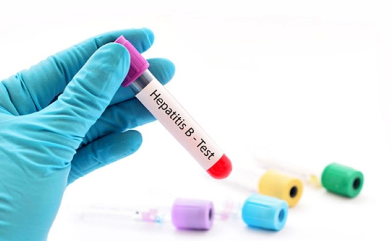 Các chỉ số định lượng virus viêm gan B đánh giá mức độ nghiêm trọng của bệnh và quyết định đến phác đồ điều trị.    