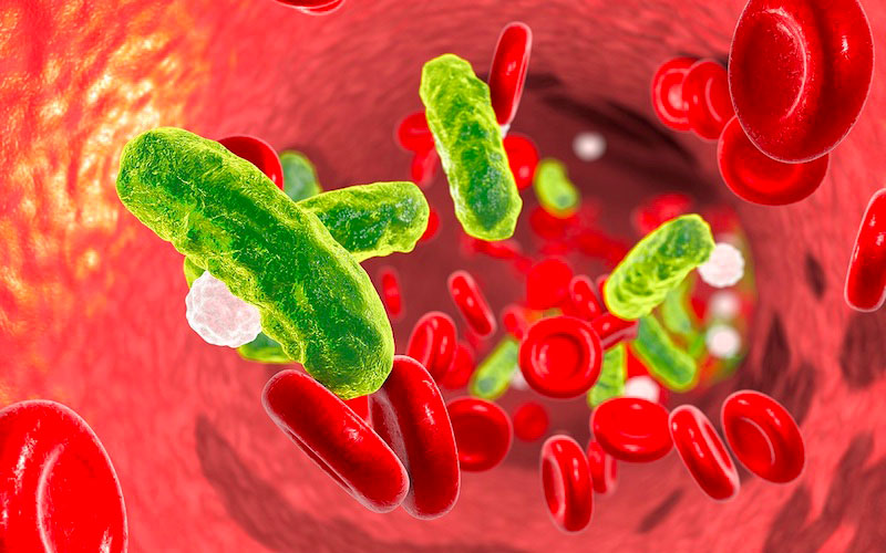 Nhiễm khuẩn huyết có nghĩa là gì?