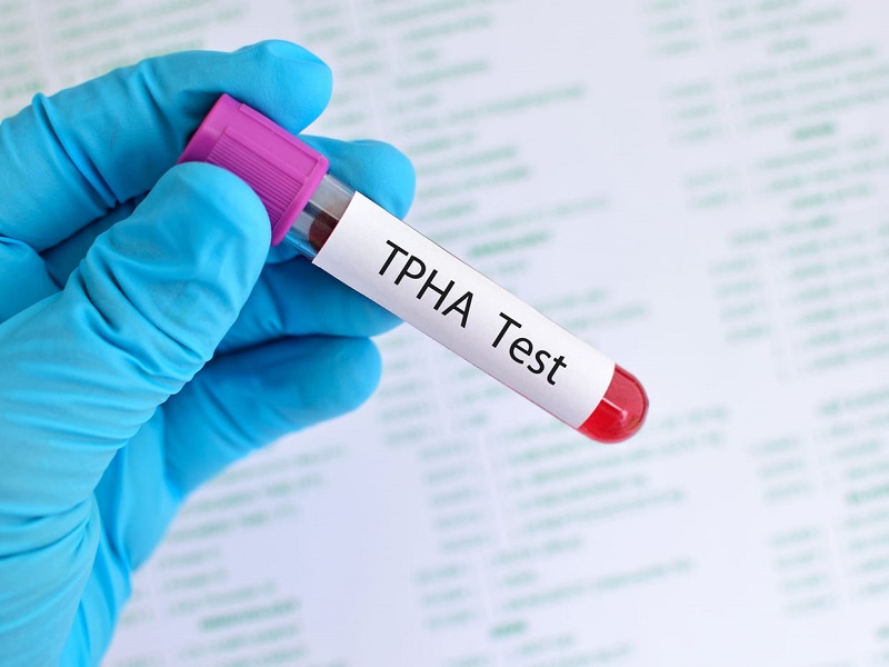 Xét nghiệm TPHA giúp chẩn đoán giang mai cho người bệnh