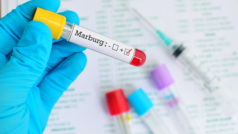 Chỉ dựa trên triệu chứng lâm sàng thì rất khó nhận biết Marburg nên cần thực hiện các xét nghiệm