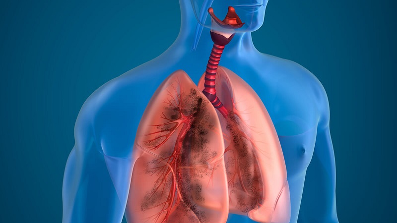 CT phổi mang lại hình ảnh chân thực và chi tiết