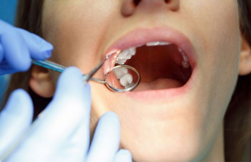 Nhổ răng khôn có nguy hiểm không?