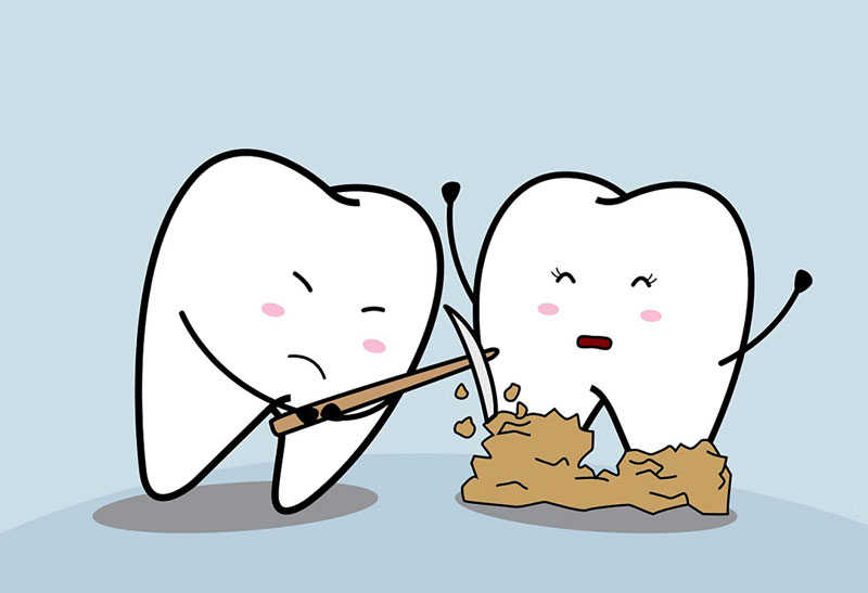 Lấy vôi răng là thủ thuật nha khoa dọn sạch các mảng bám trên nướu răng
