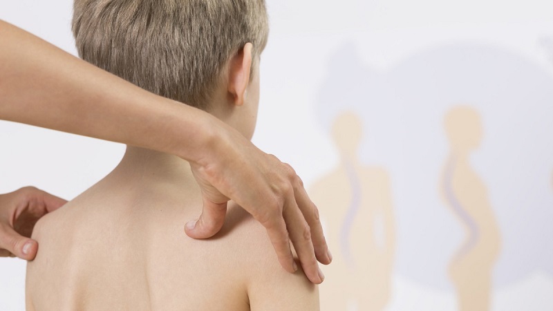 Có  nhiều nguyên nhân dẫn đến tình trạng gù lưng ở trẻ