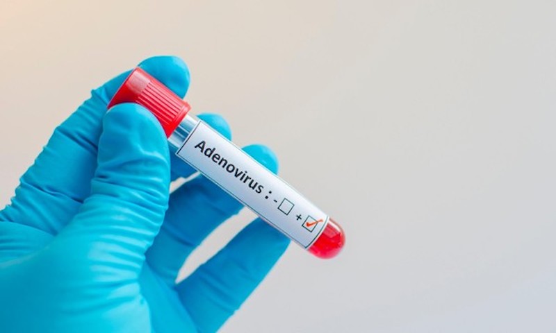 Xét nghiệm là phương pháp chẩn đoán mắc Adenovirus chính xác nhất