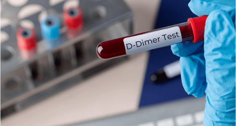 Xét nghiệm D-dimer được chỉ định cho những trường hợp nghi ngờ mắc bệnh lý về huyết khối