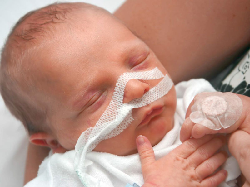 Trẻ hít phải phân su có nguy cơ bị suy hô hấp nặng