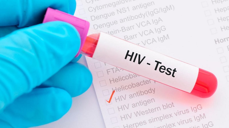 HIV khiến bất cứ ai cũng phải lo sợ