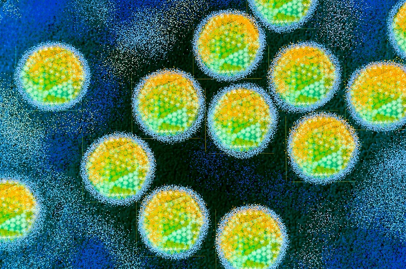 Sự tồn tại của virus có thể được nhận ra bằng kính hiển vi