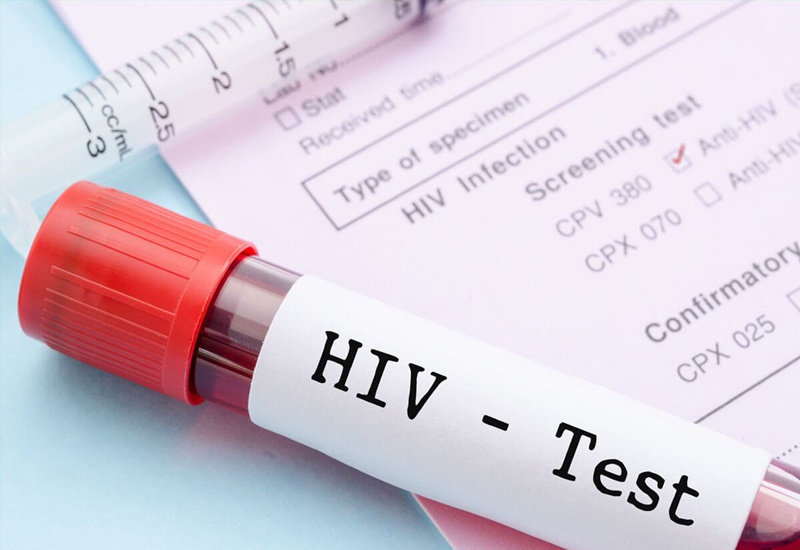 HIV gây suy giảm hệ miễn dịch của người bệnh