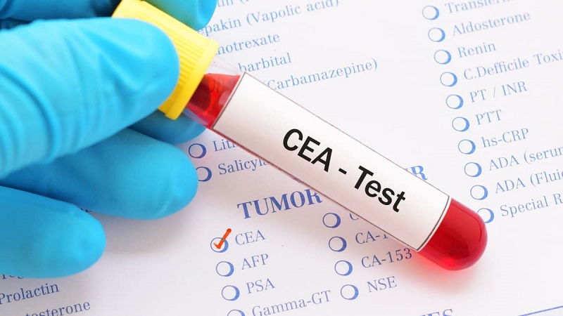 Kể cả khi test lần đầu cho thấy nồng độ CEA cao cũng không có nghĩa bạn bị ung thư