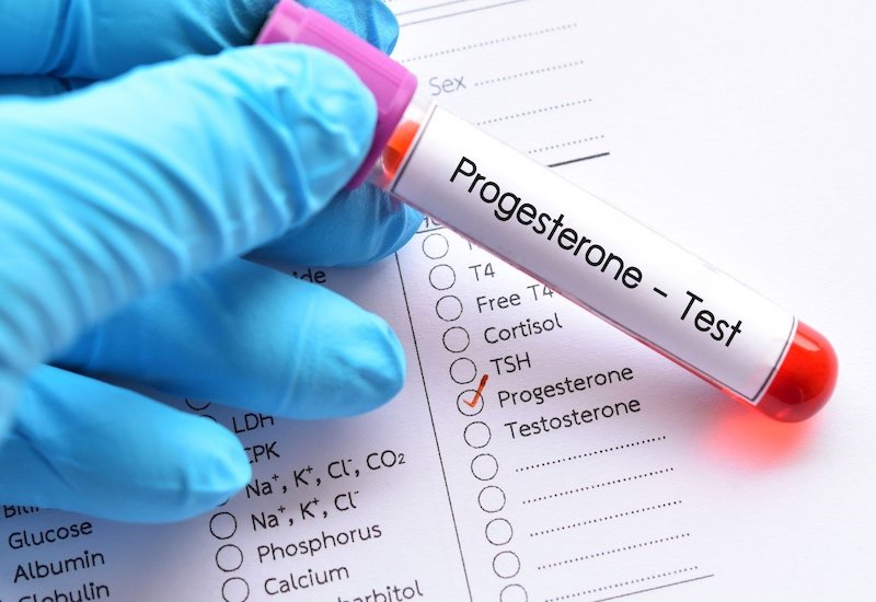 Progesterone test - xét nghiệm quan trọng trong kiểm tra nội tiết tố nữ