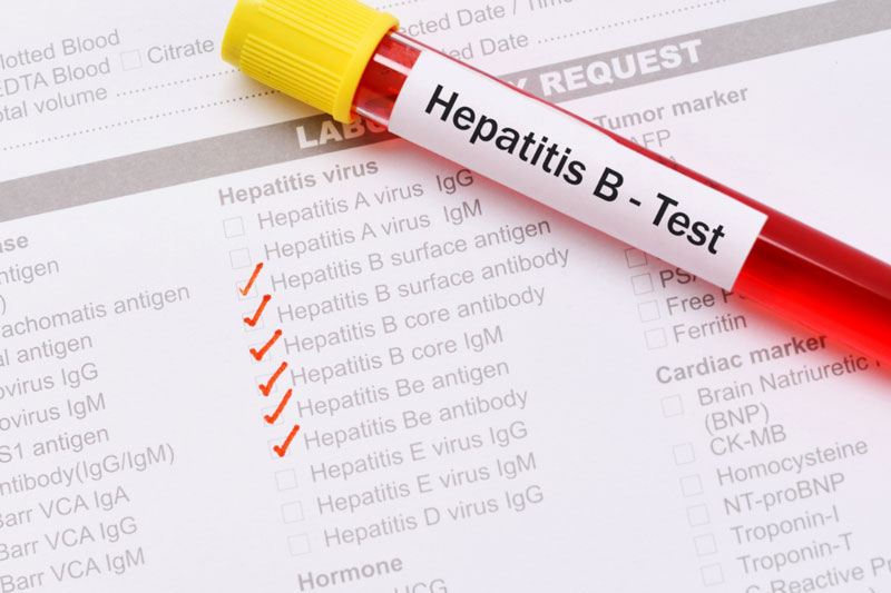 Khi phát hiện dấu hiệu bất thường, bạn nên đi xét nghiệm viêm gan B