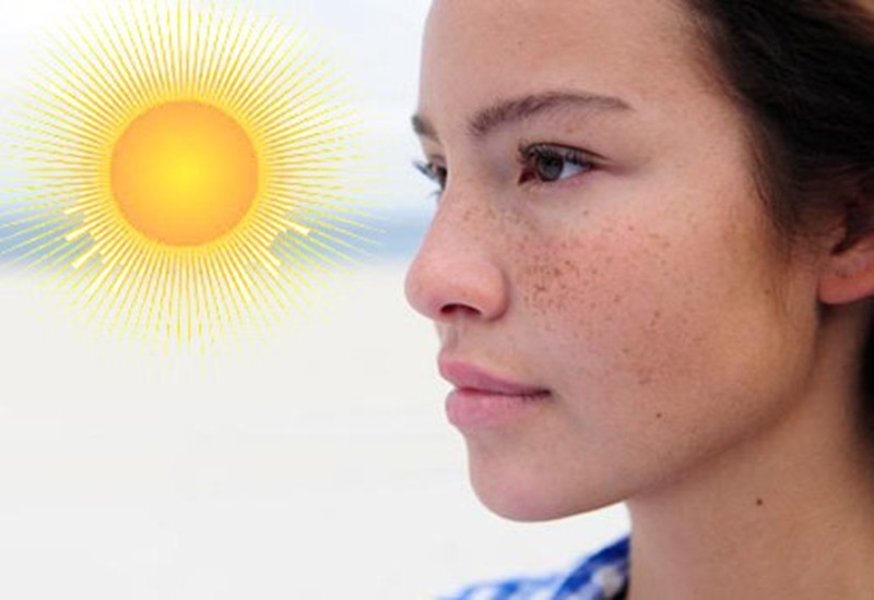 Tiếp xúc với ánh nắng mặt trời làm tăng nguy cơ lão hóa da