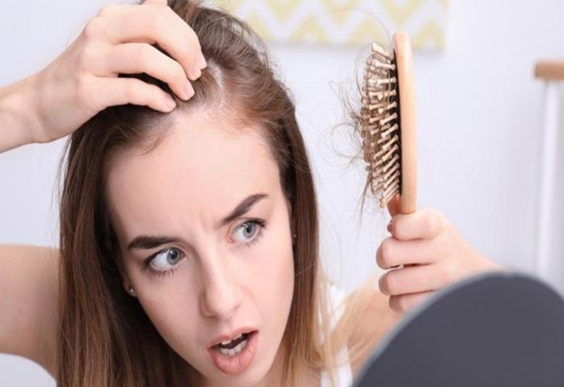 Rụng tóc ở nữ do nhiều nguyên nhân khác nhau